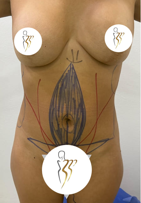 Abdomen 1