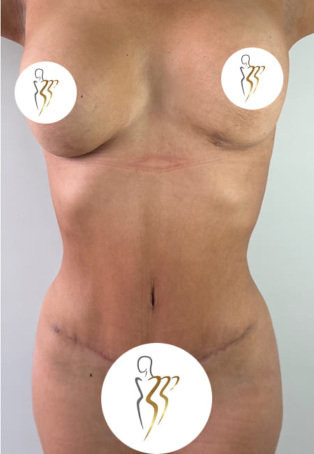 Abdomen 2