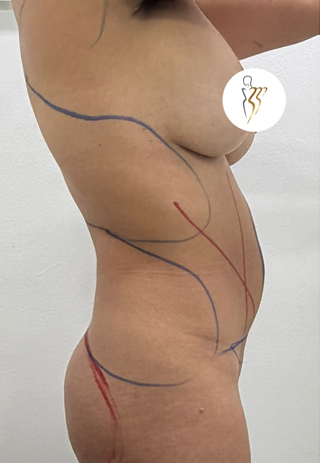 Abdomen 3