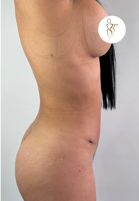 Abdomen 4