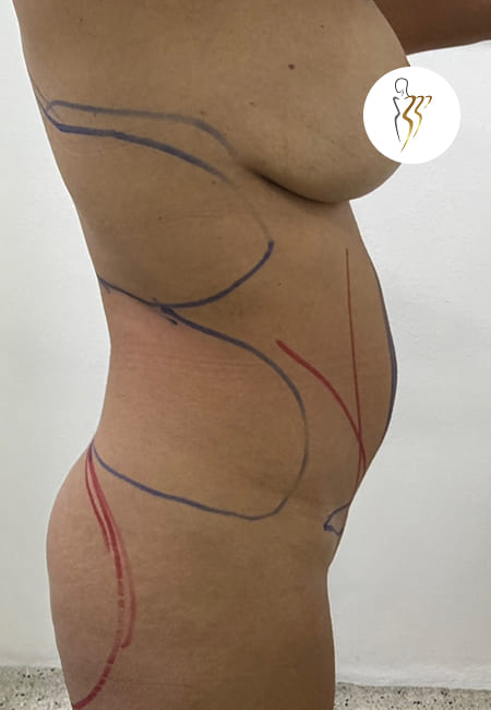 Abdomen 5