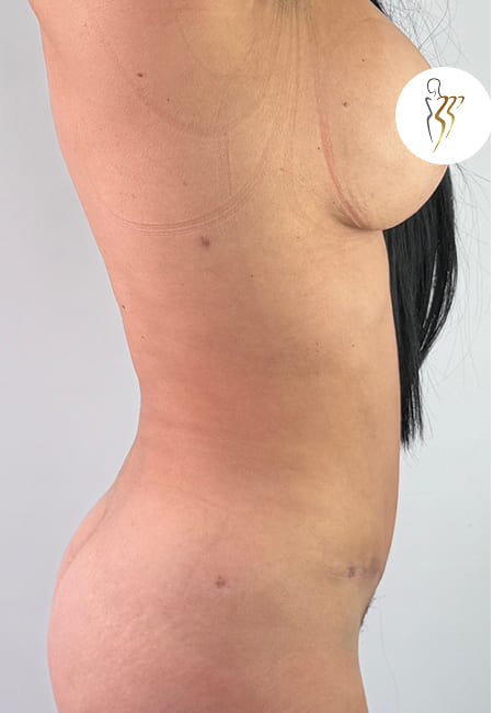 Abdomen 6